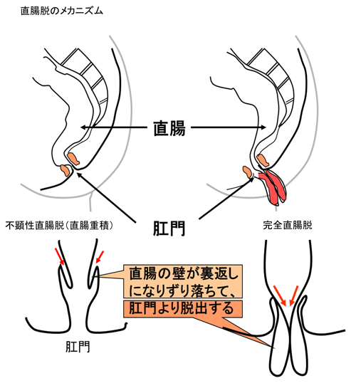 図2