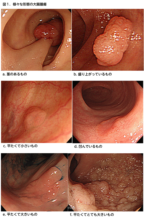 図1