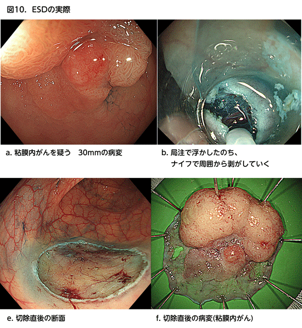 図10