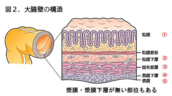 図2