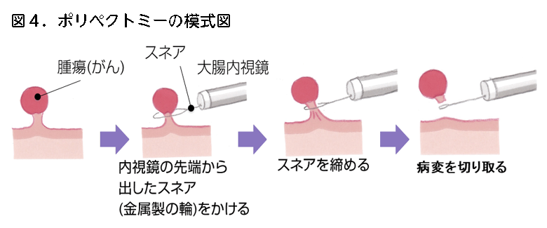 図4