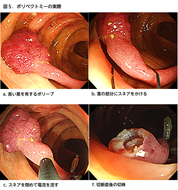 図5