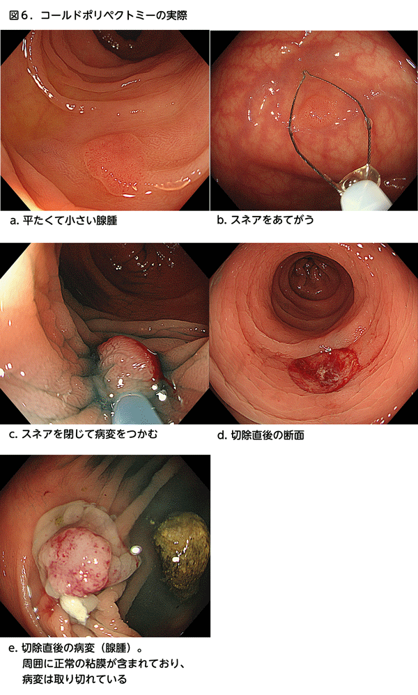 図6