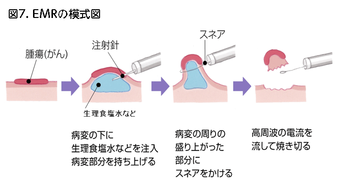 図7