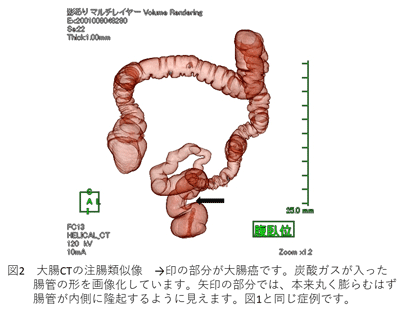 図2