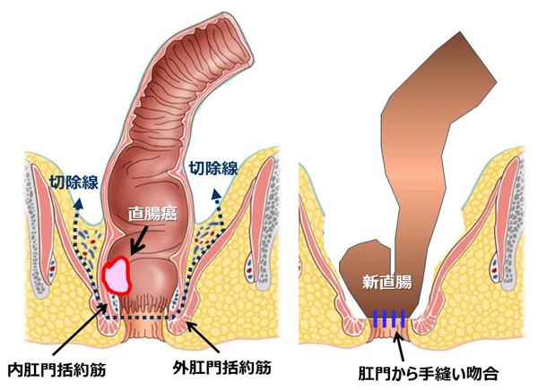 図1