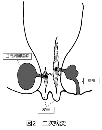 図2