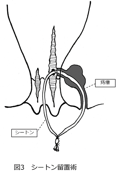 図3