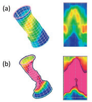 図3：3Dで肛門管の圧を立体化