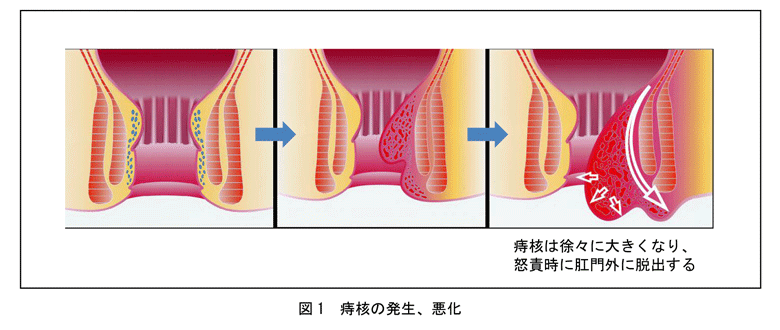 肛門がんはどのように診断されますか?