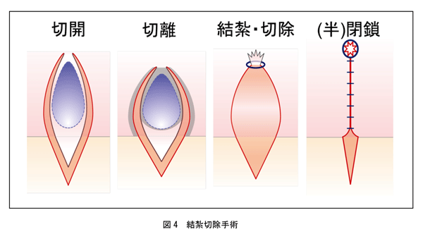 図4