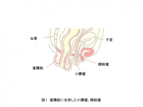 図1