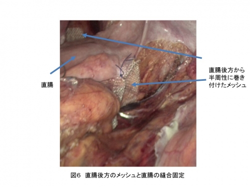 図6